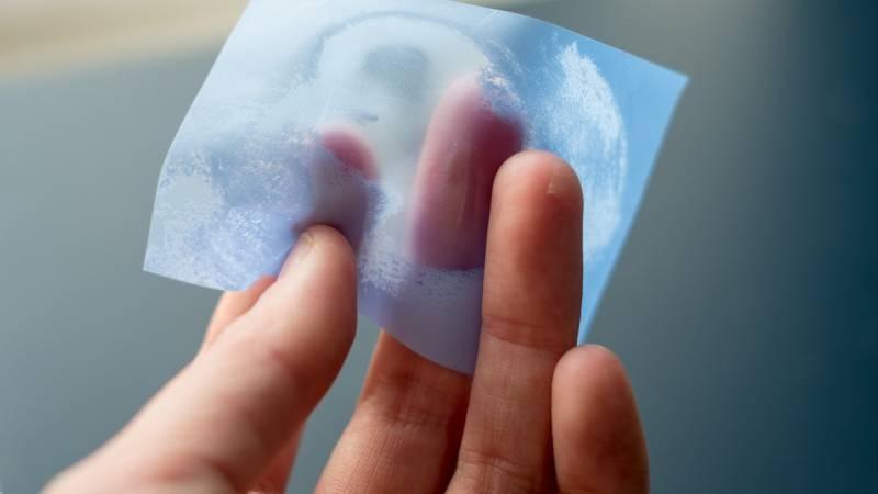 Da đổ nhiều dầu