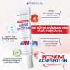 Gel chấm mụn viêm Trioderma Intensive Acne Spot: Mảnh ghép mới chăm sóc da dầu mụn