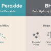 PAD vs BHA vs Benzoyl Peroxide: Ai Thắng Cho Mụn Đầu Đen?