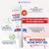 Gel chấm mụn Trioderma: Từ nghiên cứu khoa học đến giải pháp hỗ trợ chăm da mụn